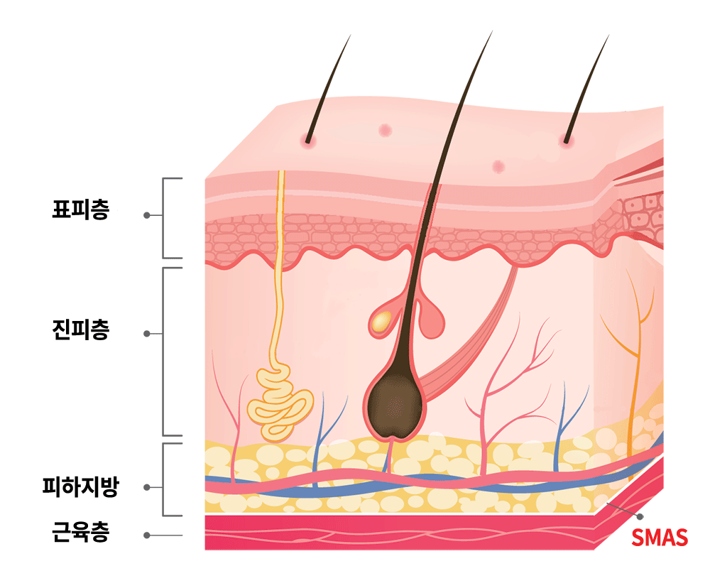 더블로 골드 리프팅