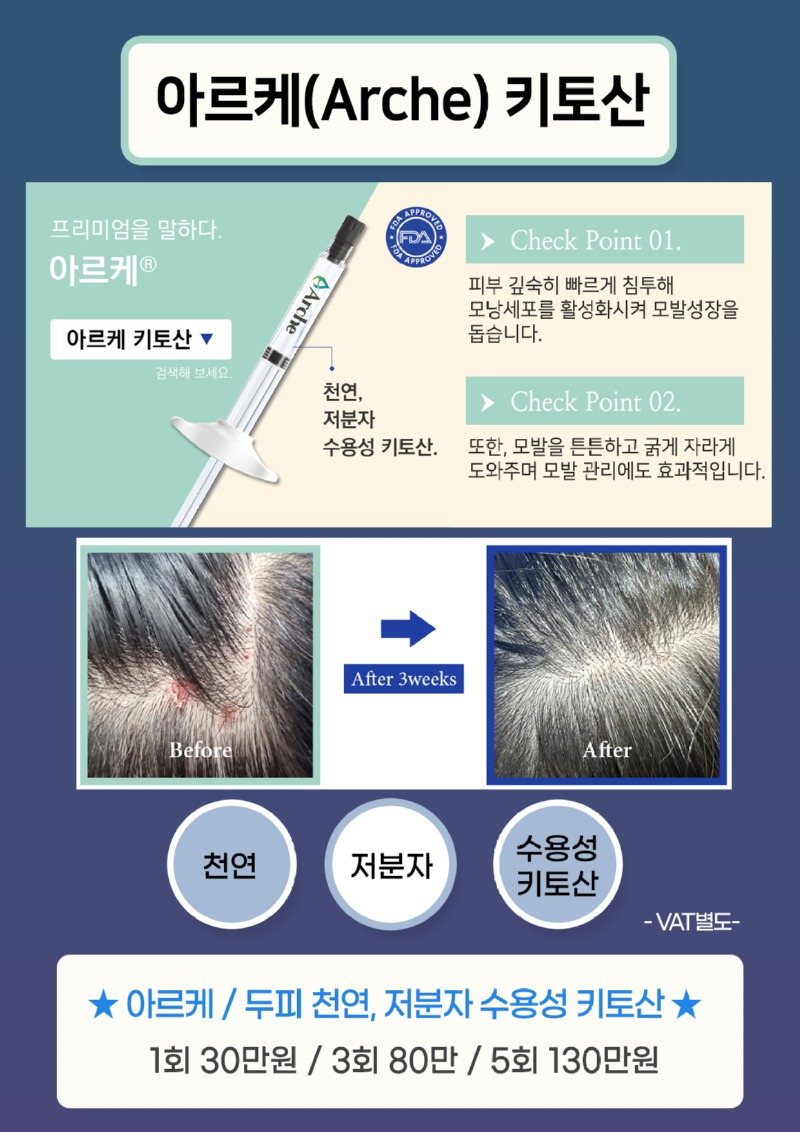 아르케키토산-1.jpg